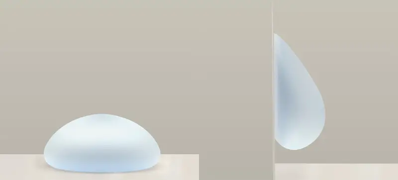 A Motiva implant with ProgressiveGel Ultima: round when lying, teardrop-shaped when standing